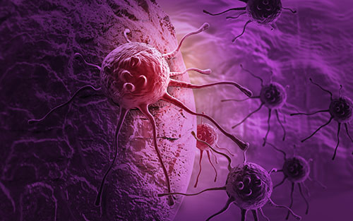 不同类型的胰腺癌开始于体内不同类型的细胞