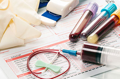 在血液样本中发现的生物标志物面板可能导致胰腺癌的早期检测