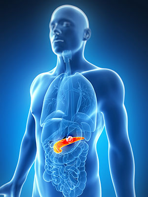 胰腺肿瘤位于胰腺，腹部深处，胃的后面。